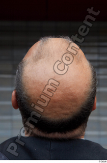 Street  662 bald hair head 0002.jpg